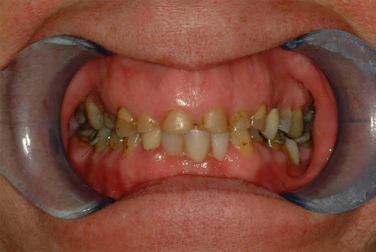 teeth