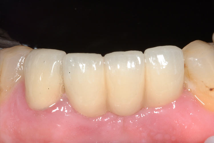 teeth