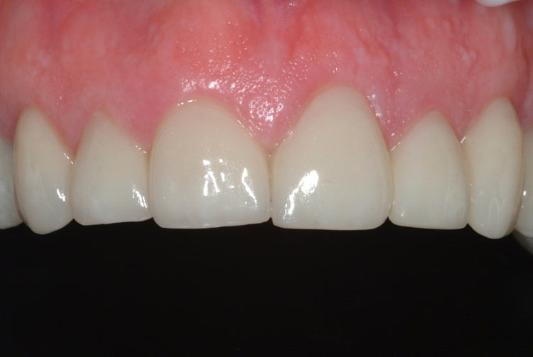 teeth