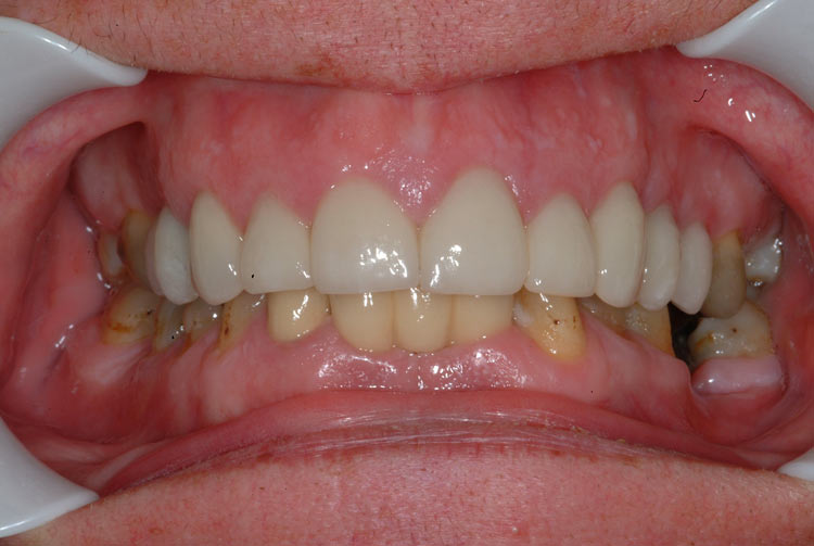 teeth